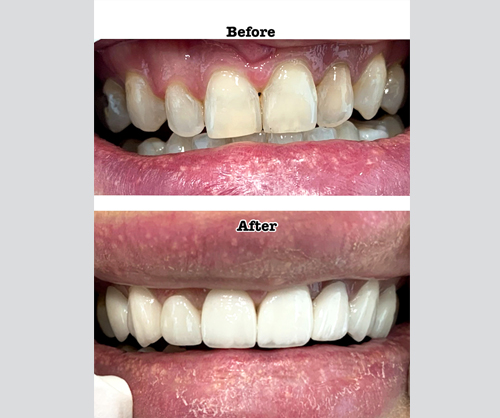 Effective dental treatment