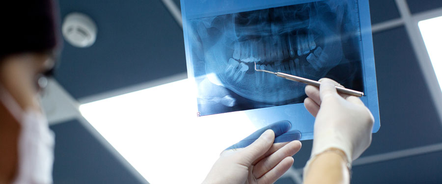 X-rays and caries detection dyes